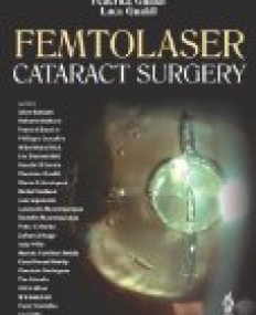 Femtolaser Cataract Surgery