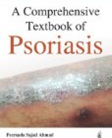 A Comprehensive Textbook of Psoriasis