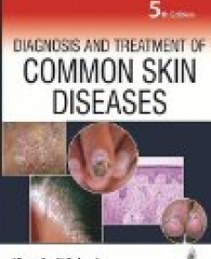 Diagnosis and Treatment of Common Skin Diseases