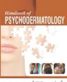 Handbook of Psychodermatology