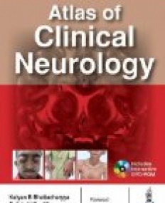 Atlas of Clinical Neurology