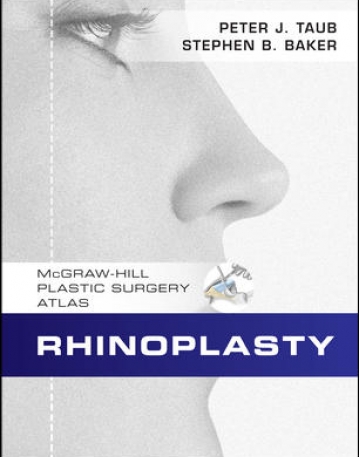 RHINOPLASTY