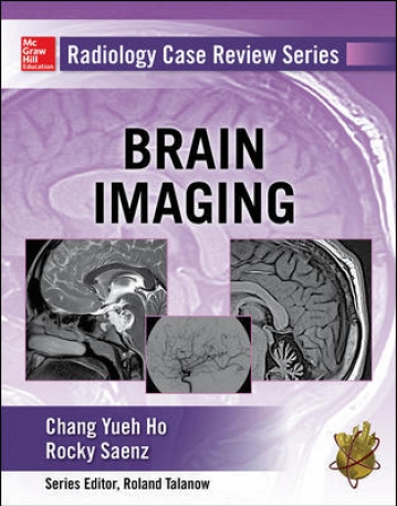 RADIOLOGY CASE REVIEW SERIES: BRAIN IMAGING