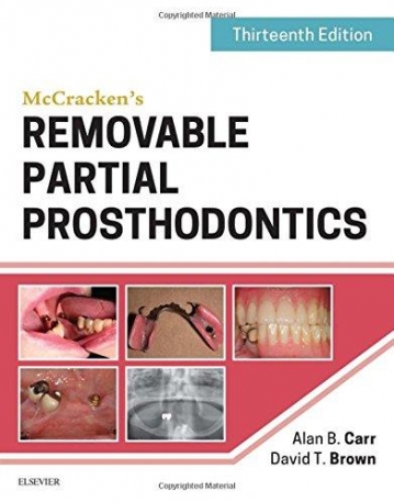 McCracken's Removable Partial Prosthodontics , 13th Edition