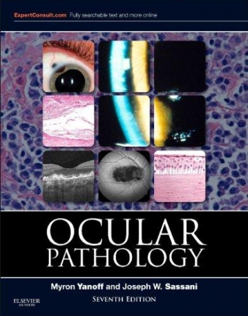 Ocular Pathology, 7th Edition