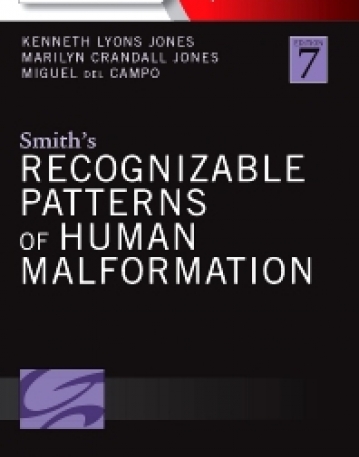 SMITH'S RECOGNIZABLE PATTERNS OF HUMAN MALFORMATION
