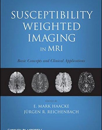 Susceptibility Weighted Imaging in MRI: Basic Concepts and Clinical Applications