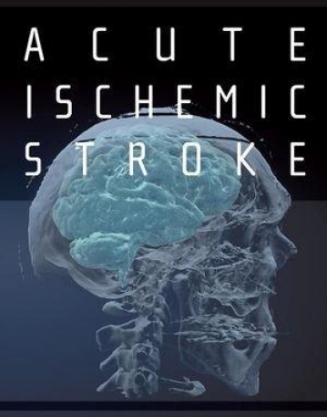Acute Ischemic Stroke: An Evidence-based Approach