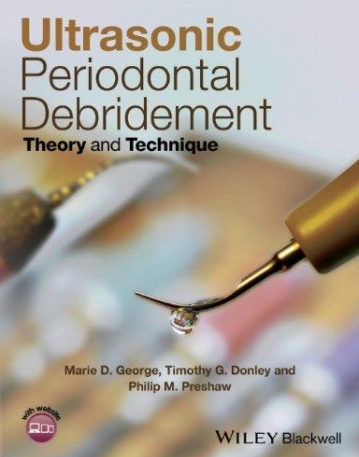 Ultrasonic Periodontal Debridement: Theory and Technique