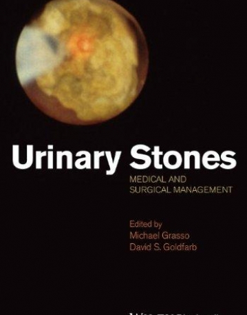 Urinary stones: Medical and Surgical Management