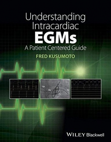 Understanding Intracardiac EGMs: A Patient Centered Guide