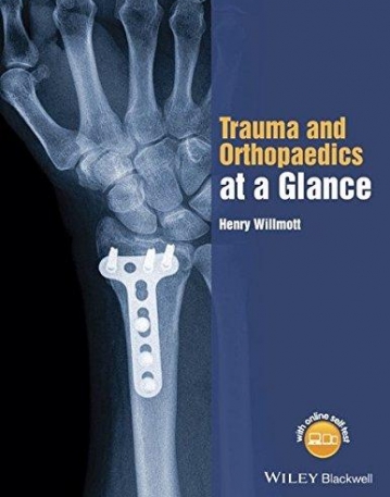 Trauma and Orthopaedics at a Glance