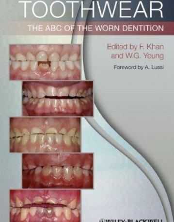 Toothwear: The ABC of the Worn Dentition