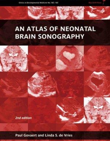 Atlas of Neonatal Brain Sonography,2e