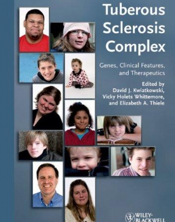 Tuberous Sclerosis Complex: Genes, Clinical Features and Therapeutics