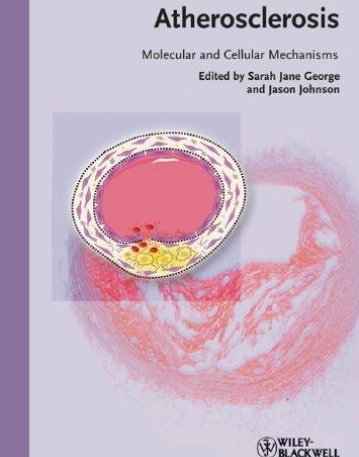 Atherosclerosis: Molecular and Cellular Mechanisms