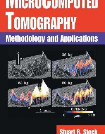 MICROCOMPUTED TOMOGRAPHY METHODOLOGY AND APPLICATIONS