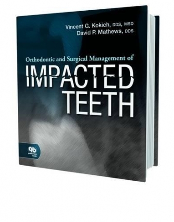 Orthodontic and Surgical Management of Impacted Teeth