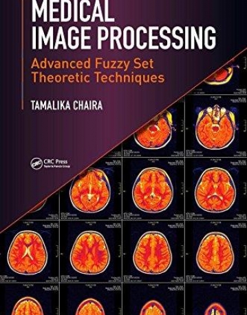 Medical Image Processing: Advanced Fuzzy Set Theoretic Techniques