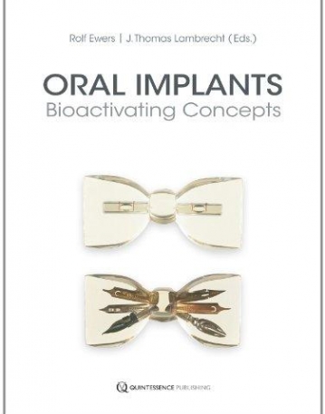 Oral Implants: Bioactivating Concepts