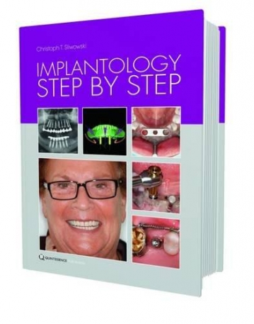 Implantology Step by Step