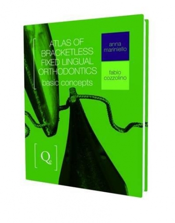 Atlas of Bracketless Fixed Lingual Orthodontics: Basic Concepts