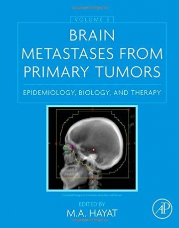 Brain Metastases from Primary Tumors, Volume 2