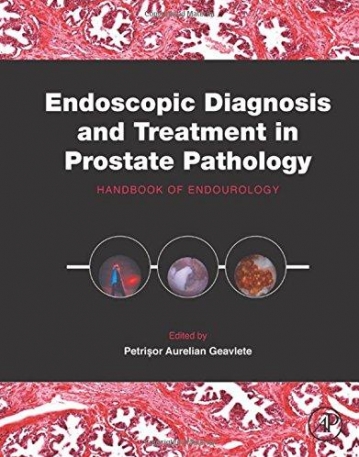 Endoscopic Diagnosis and Treatment in Prostate Pathology