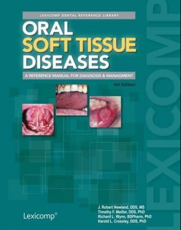 Oral soft tissue diseases