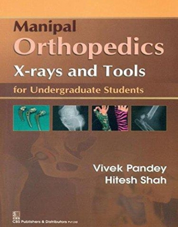 Manipal Orthopedics X-rays & Tools for Undergraduate
 Students