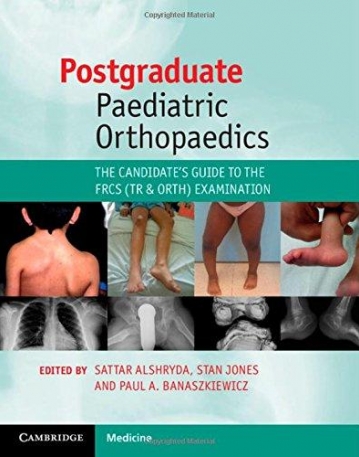 POSTGRADUATE PAEDIATRIC ORTHOPAEDICS