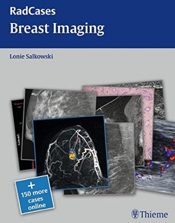 Th, radcases Breast Imaging