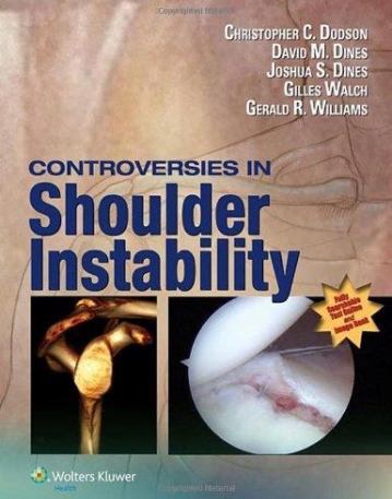 Controversies in Shoulder Instability