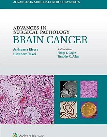Advances in Surgical Pathology: Brain Cancer (Advances in Surgical Pathology)