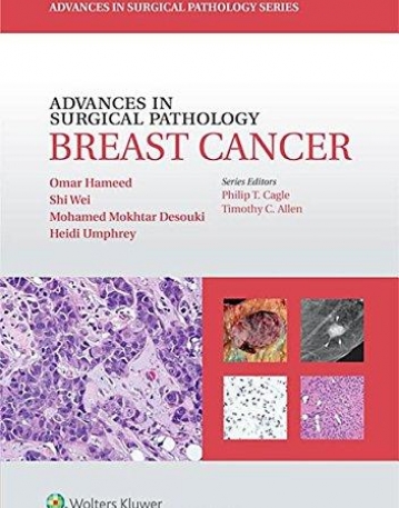 Advances in Surgical Pathology: Breast Cancer