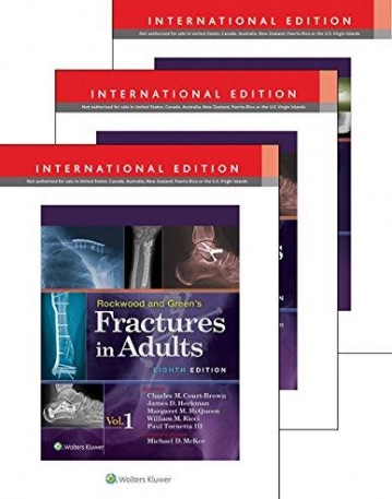 Rockwood & Wilkins' Fractures Package in 3 Volumes, 8 IE