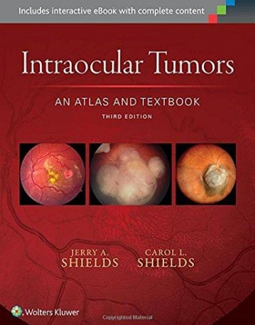 Intraocular Tumors: An Atlas and Textbook