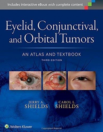 Eyelid, Conjunctival, and Orbital Tumors: An Atlas and Textbook