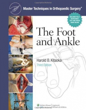 Master Techniques in Orthopaedic Surgery: Foot and Ankle