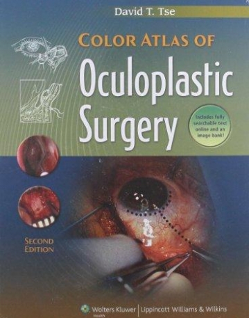 Color Atlas of Ophthalmic Plastic Surgery