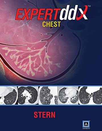 EXPERTddx: Chest: Published by Amirsysآ® (EXPERTddx (TM))آ 