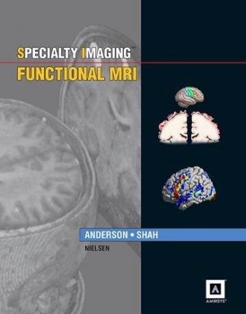 Specialty Imaging: Functional MRI: Published by Amirsys