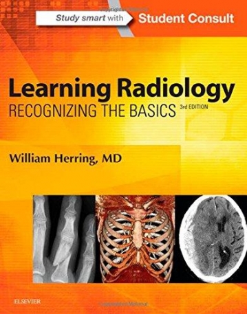 LEARNING RADIOLOGY, RECOGNIZING THE BASICS, 3RD EDITION