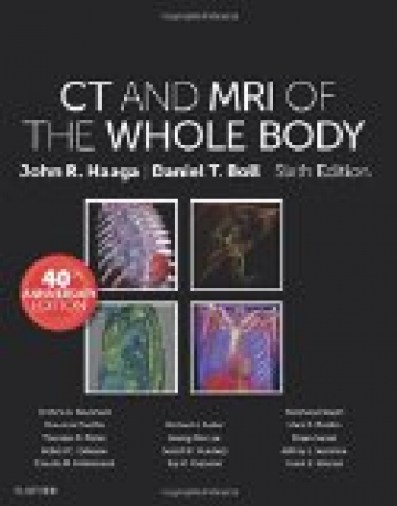 CT and MRI of the Whole Body, 2-Volume Set, 6th Edition