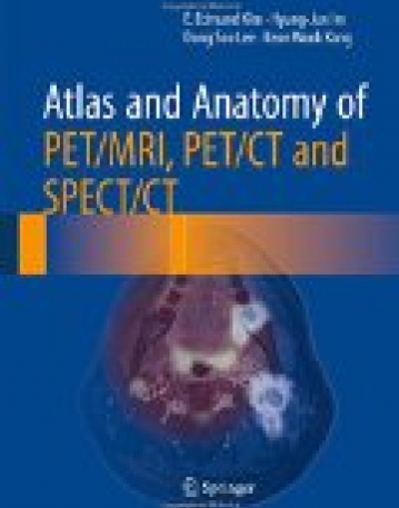 Atlas and Anatomy of PET/MRI, PET/CT and SPECT/CT