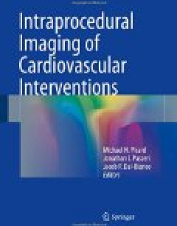 Intraprocedural Imaging of Cardiovascular Interventions