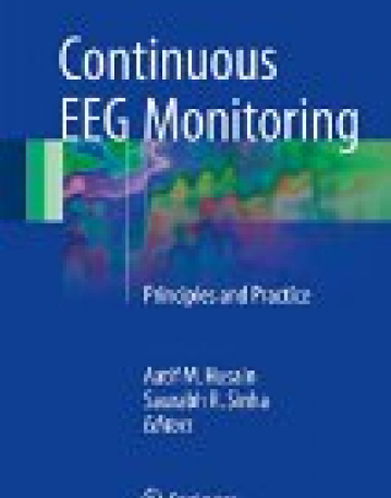 Continuous EEG Monitoring: Principles and Practice