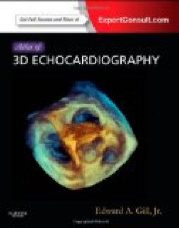 Atlas Of 3d Echocardiography