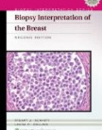 Biopsy Interpretation Of The Breast (Biopsy Interpretation Series