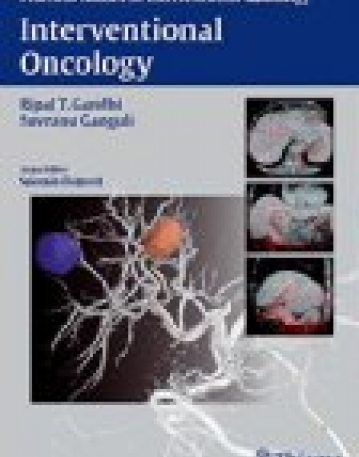 Interventional Oncology